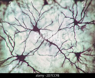 2D illustration, neurons and their connections. Microscopic photo simulation of the human nervous system. Stock Photo