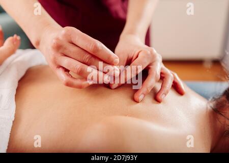 Physiotherapist holding needle on woman back Stock Photo