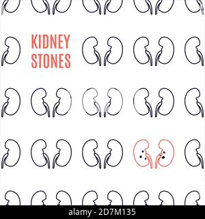 Kidney stone disease awareness poster, conceptual illustration. Stock Photo