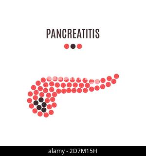 Pancreatitis awareness poster, conceptual illustration. Stock Photo