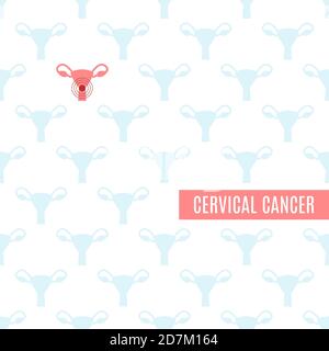 Cervical cancer poster, conceptual illustration. Stock Photo