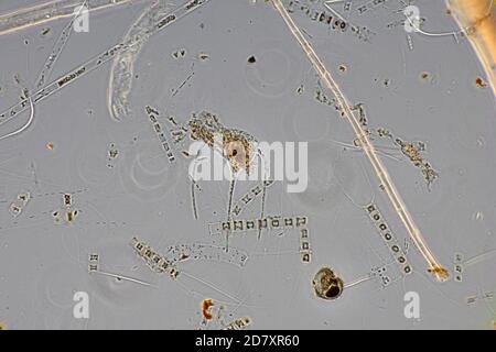 Marine Phytoplankton, Bacteriastrum, Naples, MID 1800's, unpolluted waters Stock Photo