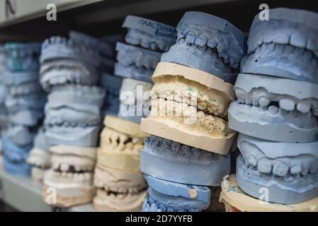 Place of storage of plaster models of human jaws in an orthodontic clinic. Control and diagnostic dental casts Stock Photo