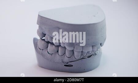 Dental casting gypsum model plaster cast stomatologic human jaws prothetic laboratory, technical shots. Sahllow dof. Stock Photo