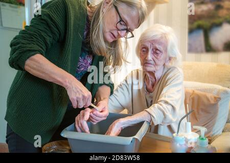 The 92 year old Mother suffers with dementia and macular blindness,she has dirty fingernails due to picking her food, is not in pain but worried that Stock Photo