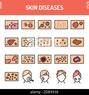 Skin diseases color line icons set. Isolated vector element. Outline pictograms for web page, mobile app, promo Stock Vector