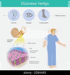 causes of vertigo in elderly