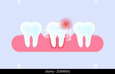 Teeth banner. Tooth with pain. Caries and toothache. Teeth care concept. Vector on isolated background. EPS 10 Stock Vector