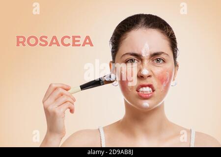 Portrait of a young Caucasian woman who is angry and puts a brush mask on her face with rosacea red cheeks. Beige background.Concept of rosacea, healt Stock Photo
