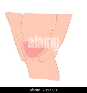 graphics image Tendon bone knee joint problems on leg vector illustration Stock Vector