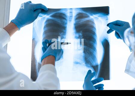 close up. medical colleagues discussing an x-ray of the lungs . Stock Photo