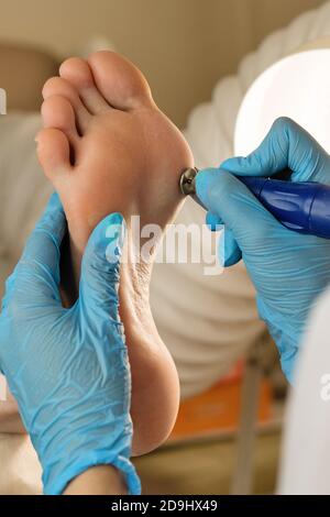 Podiatrist using grinding equipment and making procedure polish for feet hardware pedicure. Callus peeling using professional pedicure drill machine. Spa foot treatment. Removing hard, callused skin Stock Photo