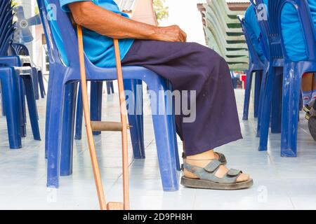 closeup a man suffering from leprosy with wooden crutch Stock Photo