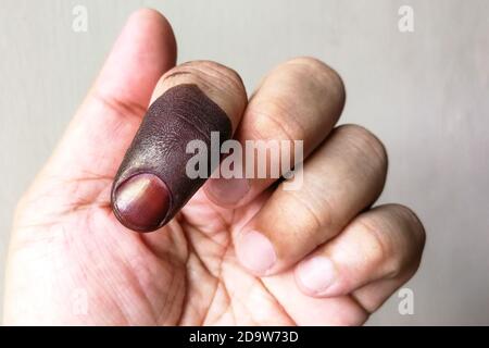 Index finger with indelible ink stain after voting in election Stock Photo