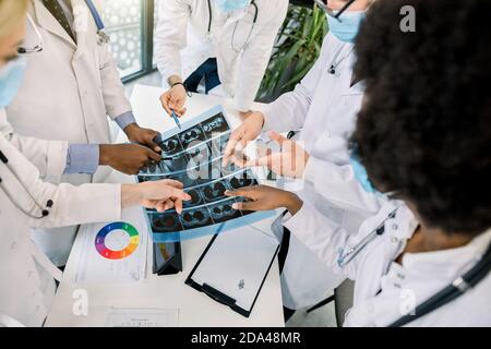 Computed tomography concept, covid 19 pandemy. Close up cropped top angle image of multiracial group of doctors looking at X-ray CT scan of lungs and Stock Photo
