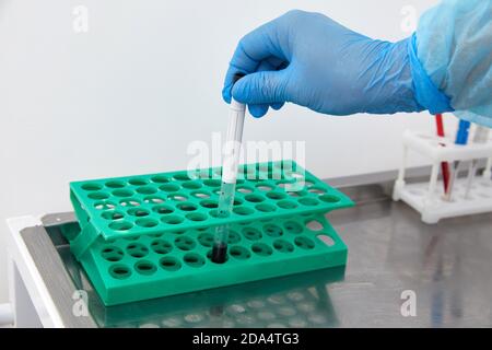 Scientist working with blood sample in laboratory Stock Photo