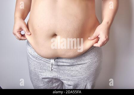 female belly after childbirth, excess fat and stretched skin Stock Photo