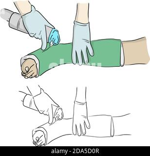 close-up hand cutting plaster cast at leg and foot patient to immobilize after fracture injury vector illustration sketch doodle hand drawn with black Stock Vector