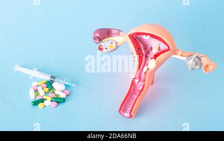 Mock up of the female reproductive system and a bunch of pills and injections on a blue background. Concept of drug treatment of genital infections, a Stock Photo