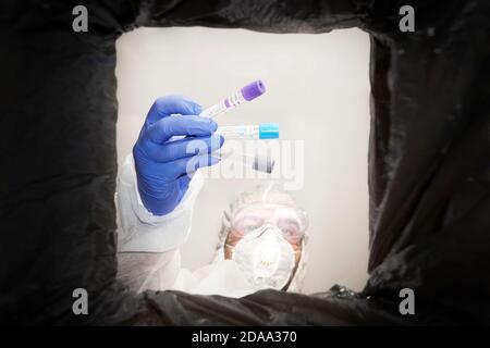 a man in a protective suit throws used medical test tubes into a trash can. Bottom view from the trash can. The problem of recycling and pollution of Stock Photo