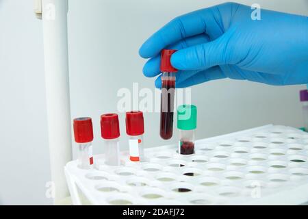 Scientist working with blood sample in laboratory Stock Photo