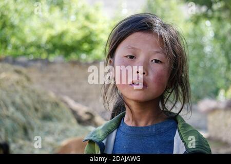 Portrait of a pensive little girl of Tibetan ethnicity with a sunburn on her face. Stock Photo