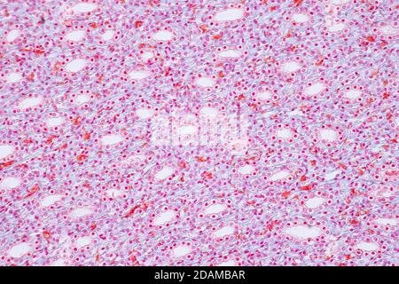 Human kidney, light micrograph. Stock Photo