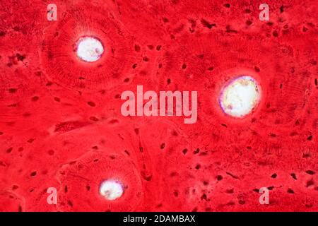 Human compact bone tissue, light micrograph. Stock Photo