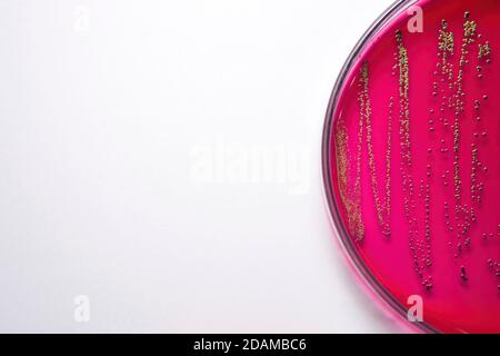 Escherichia coli bacteria on blood agar selective media. Stock Photo