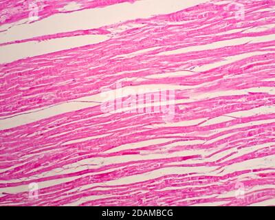 Human cardiac muscle, light micrograph. Cardiac muscle is one of the three types of muscle tissue in the human body. The other two types are skeletal Stock Photo