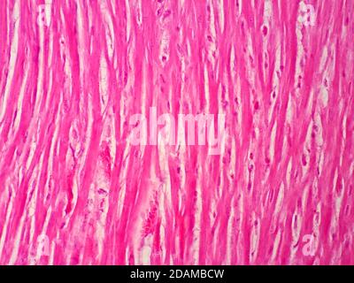 Human cardiac muscle, light micrograph. Cardiac muscle is one of the three types of muscle tissue in the human body. The other two types are skeletal Stock Photo