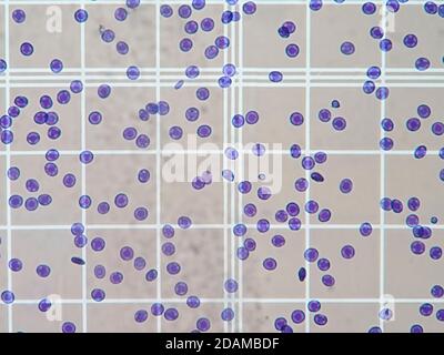 Blood cells in a counting chamber under a light microscope. Stock Photo