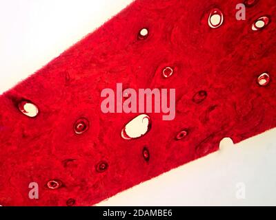 Human compact bone tissue, light micrograph. Stock Photo