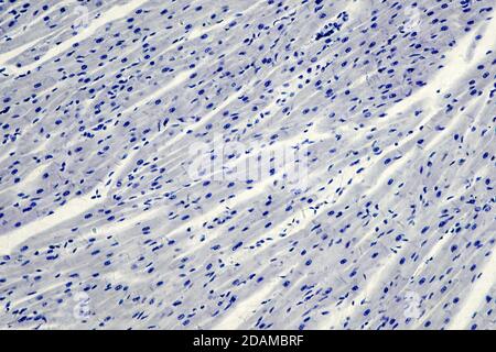 Cardiac muscle, light micrograph. Stock Photo