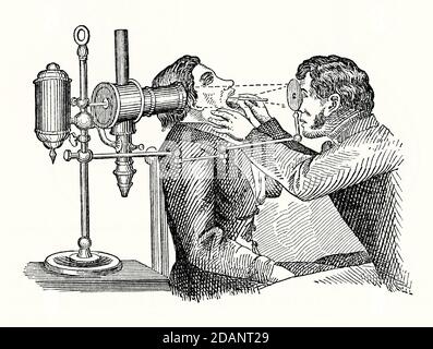 An old engraving of a patient having his larynx examined by a doctor using a laryngoscope. It is from a Victorian mechanical book of the 1880s. Laryngoscopy is endoscopy of the larynx, part of the throat in order to view the vocal folds and the glottis. Many versions of the apparatus were invented in the 1800s. The one illustrated is a Tieman laryngoscope. An artificial light source (left) shines onto the concave mirror the doctor holds and is reflected down the patient’s mouth onto a smaller mirror on the end of the instrument inserted into the mouth, illuminating the area for inspection. Stock Photo