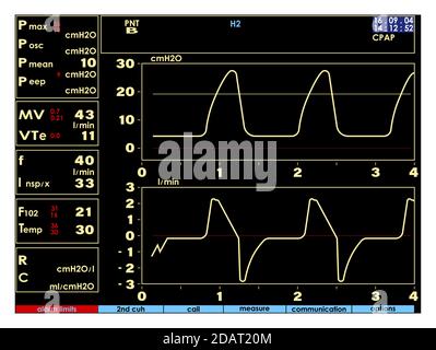 Screen, monitor with signs of the artificial lung ventilation device in a realistic design. Isolated vector Stock Vector