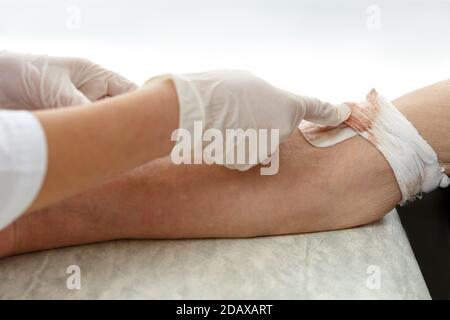 Hands nurse in gloves insert the needle into the patient's vein close-up Stock Photo