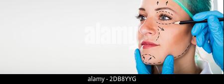 Face Lift Cosmetic Surgery And Liposuction Lines On Woman Face Stock Photo