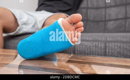 Man with broken leg in cast on couch at home. Sports injury concept. Stock Photo