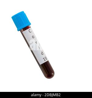 Blood collection tubes from covid 19 patients on a white laboratory table. (Clipping Path include). Stock Photo