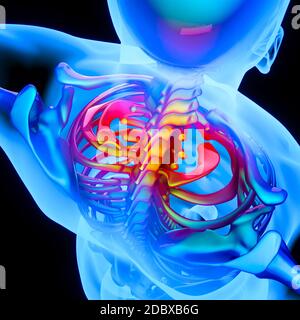 inflammation of the spine to the cervical vertebrae, stiff neck. 3d render. Stock Photo