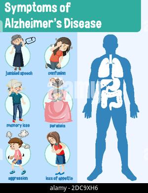 Symptoms of Alzheimer's Disease Infographic illustration Stock Vector