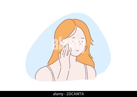 Teenage girl skincare problem concept. Woman with facial rash, lady applies cream, ointment on skin with acne pimples, covers freckles with foundation Stock Vector