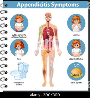 Appendicitis Symptoms Information Infographic Illustration Stock Vector Image Art Alamy