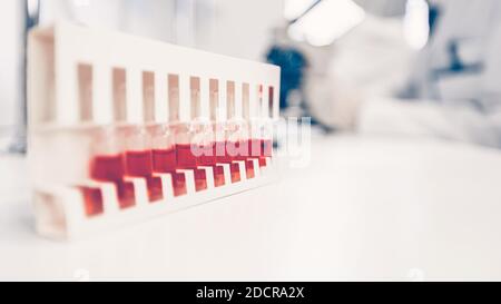 background image of a test tube with test results on a table in the laboratory . Stock Photo