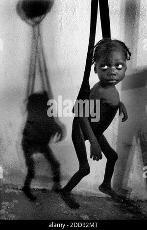 NO FILM, NO VIDEO, NO TV, NO DOCUMENTARY - File picture dated November 21, 2008, of four-year-old Venecia Lonis, now 16 pounds after two weeks of care. Venecia was so malnourished when she first reached a clinic in Martissant, Haiti, that her mother was planning her funeral. Haiti, long-ranked as the poorest nation in the Western Hemisphere, saw its people buckle under the cruelty of a merciless hurricane season in 2008. Four consecutive storms slammed the island nation, leaving in their wake staggering death tolls and massive destruction to an already-frail way of life. The picture has been t Stock Photo