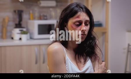 Beaten woman siting on the chair pushed by violent husband. Traumatised abused terrified beaten wife covered in bruises suffering injury from alcoholic aggressive brutal drunk man. Stock Photo