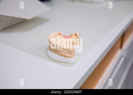 Plaster cast of jaw placed on white table in medical room of modern dental clinic Stock Photo