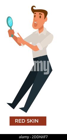 Red skin sunburn symptom isolated icon redness Stock Vector