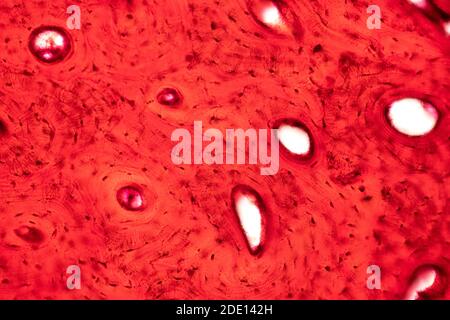 Human compact bone tissue, light micrograph Stock Photo